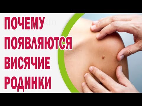 Боль в спине 16 неделя Применение мокрицы от суставов