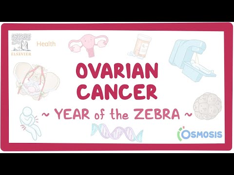 Ovarian cancer (Year of the Zebra)