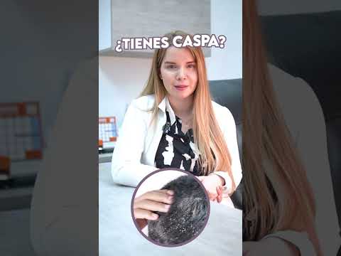 Tratamiento para la caspa en Barranquilla por la dermatóloga Erika Ariza