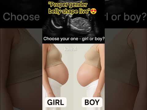 "Proper gender belly shape live😍 choose your one🤗"#baby #ultrasound #pregnancyscan