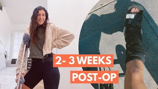 Achilles Tendon Rupture | 2-3 WEEKS post op, stitches out, washing leg, foot at neutral – Part 6