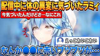 配信中に何気なく腕を見ると謎を発疹を見つけ焦るラミィ【雪花ラミィ/ホロライブ切り抜き】