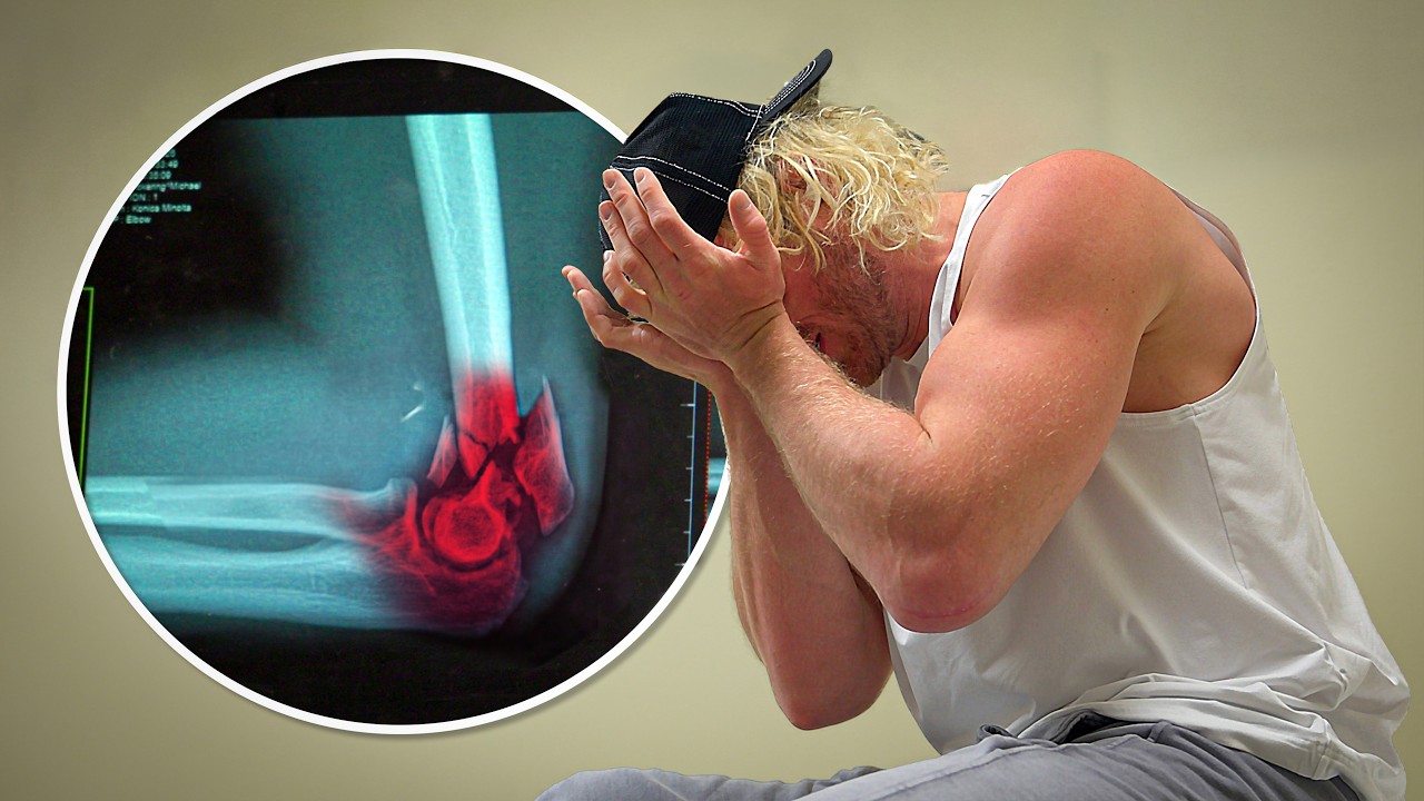 Bad News About My Tricep