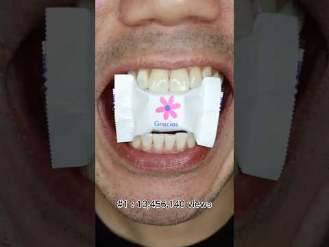 Here's the viral video everyone is sharing on YouTube 😱 #DoctorTristanPeh #ASMR see more 👇