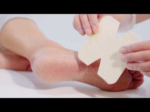 UrgoCleanAg and UrgoStart Plus - How to cut