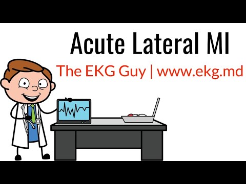 Acute Lateral MI on EKG / ECG l The EKG Guy - www.ekg.md