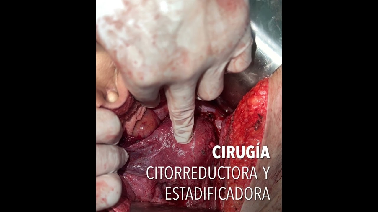 Ángel Millán Juárez-81