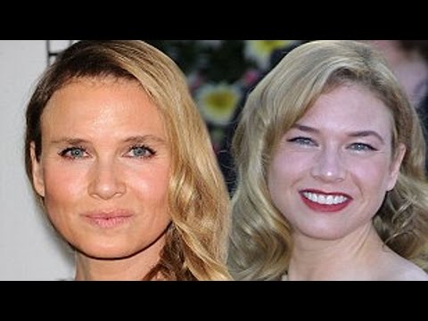 What’s Wrong With Renee Zelwegger’s Face?
