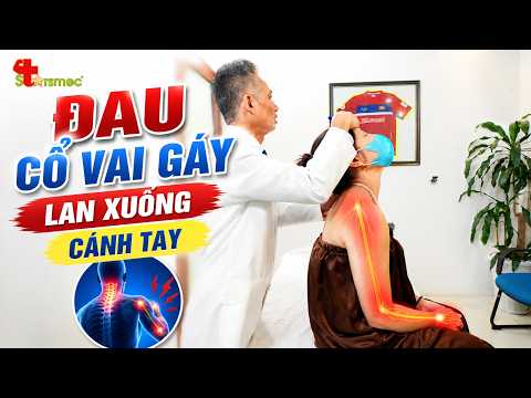 Đau cổ vai gáy lan xuống cánh tay: Cảnh báo chèn ép dây thần kinh cổ