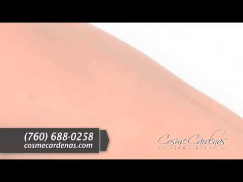 Dr. Cosme Cardenas Spot ENG