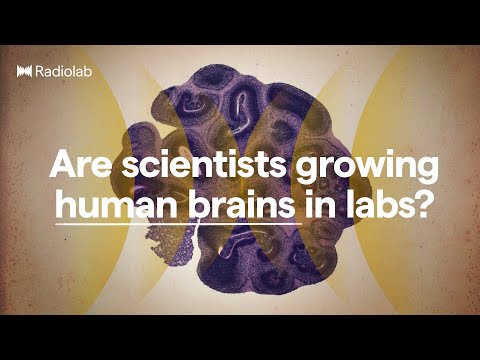 Brain Balls | Radiolab Podcast