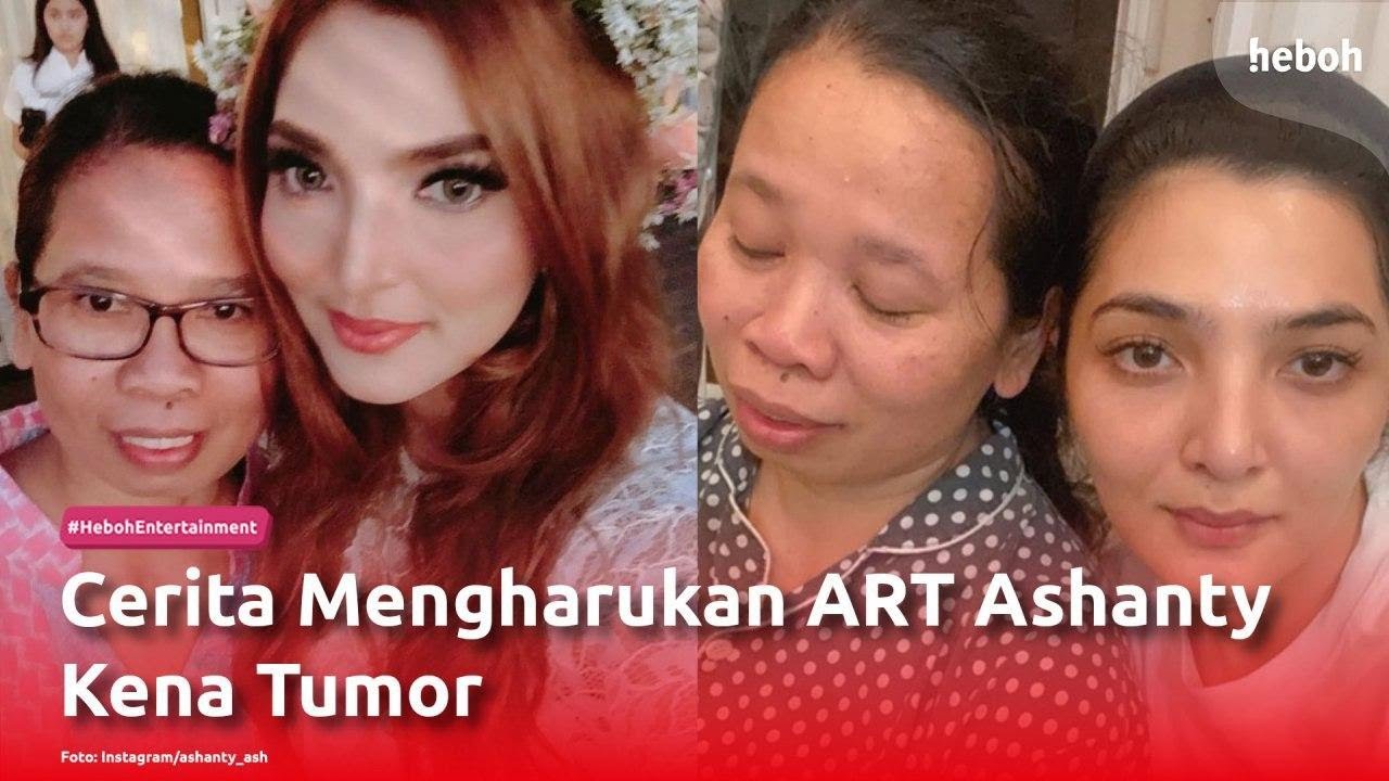 Cerita Mengharukan ART Ashanty Kena Tumor