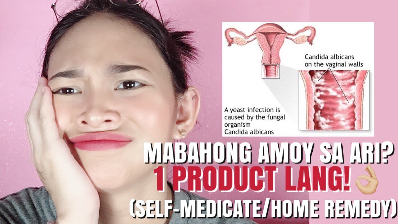 Putar video HOW TO TREAT VAGINAL YEAST INFECTION IN 1 DAY AND SYMPTOMS (MABAHO NA ARI) MAY AMOY NA PUWERTA sekarang HOW TO TREAT VAGINAL YEAST INFECTION IN 1 DAY AND SYMPTOMS (MABAHO NA ARI) MAY AMOY NA PUWERTA