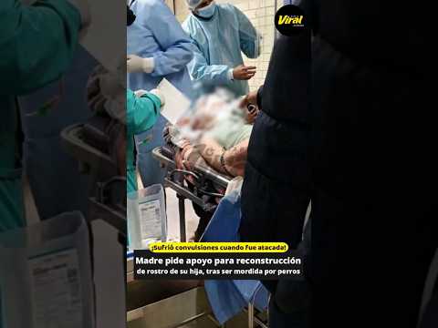 Arequipa: joven atacada por sus perros en Puno necesita apoyo para reconstrucción de rostro