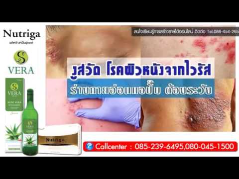 Psychosomatics หนังศีรษะโรคสะเก็ดเงิน โรคสะเก็ดเงินหนองเฉียบพลัน