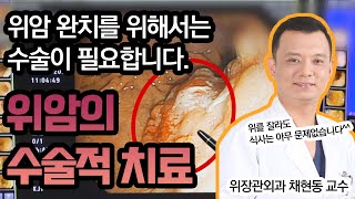 위암의 수술적 치료