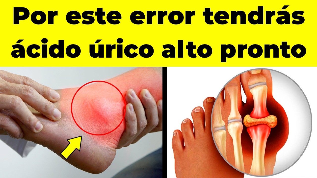 ¡ALERTA! Este alimento es el que MÁS TE SUBE EL ÁCIDO ÚRICO y nadie te lo dice