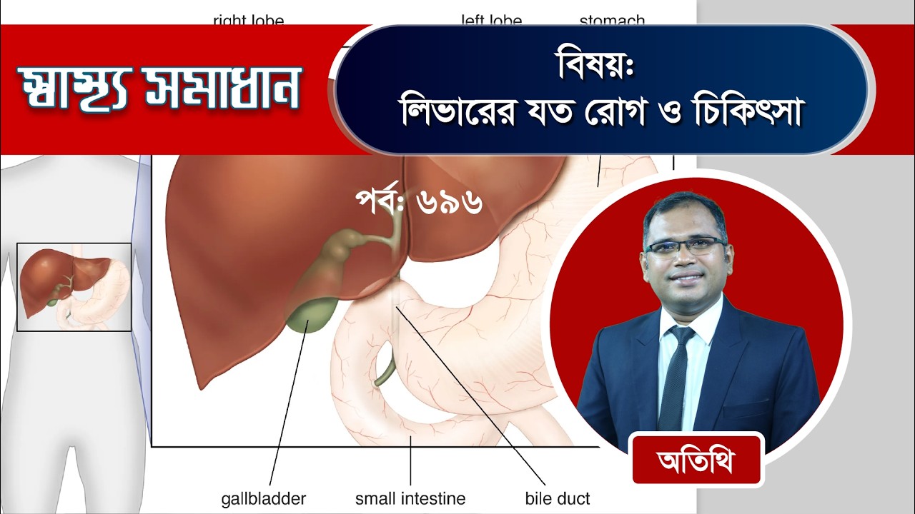 লিভারের যত রোগ ও চিকিৎসা (স্বাস্থ্য সমাধান, পর্ব: ৬৯৬)