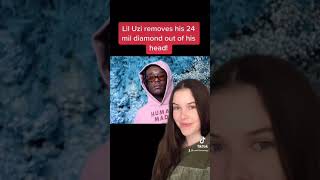 Lil Uzi Removes 24 Million Dollar Diamond From His Head!