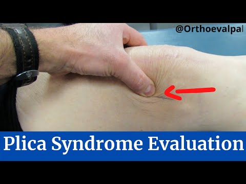 Quadriceps Repair 3 Weeks Post Op