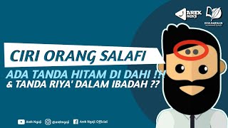 Download lagu Is a black mark on the forehead a characteristic of a Salafi? - Ustadz Dzulqarnain bin Muhammad S... mp3