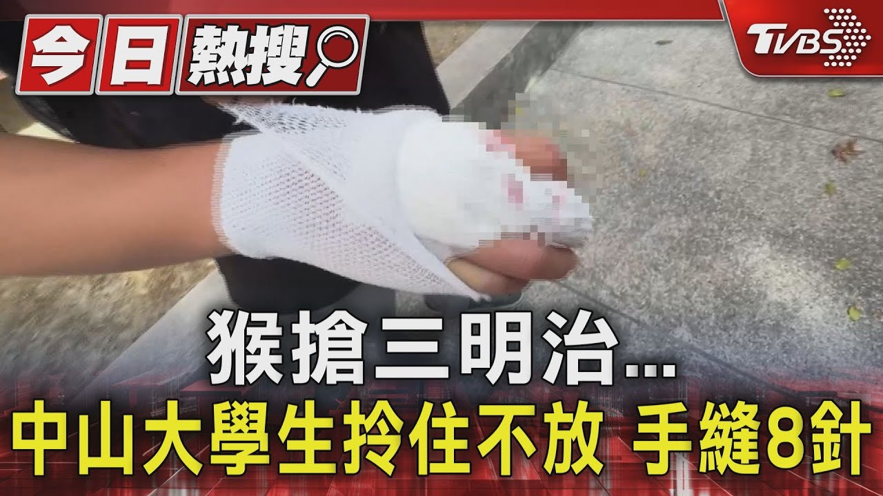 跟猴搶食下場慘!潑猴搶三明治 中山男大生手縫8針