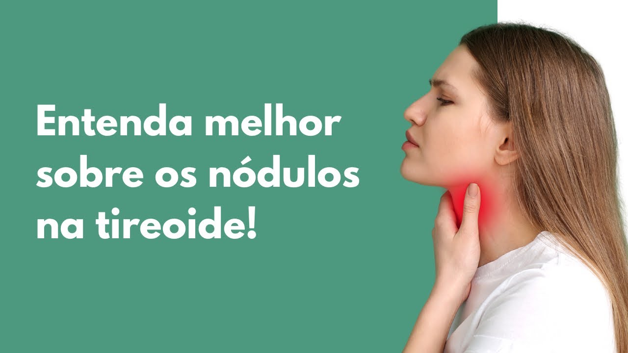 Entenda melhor sobre nódulos na tireoide
