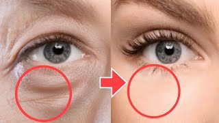 Anti-Aging Face Exercises For Eye Bags, Eye Wrinkles, Dark Circles Under Eyes | No Surgery!