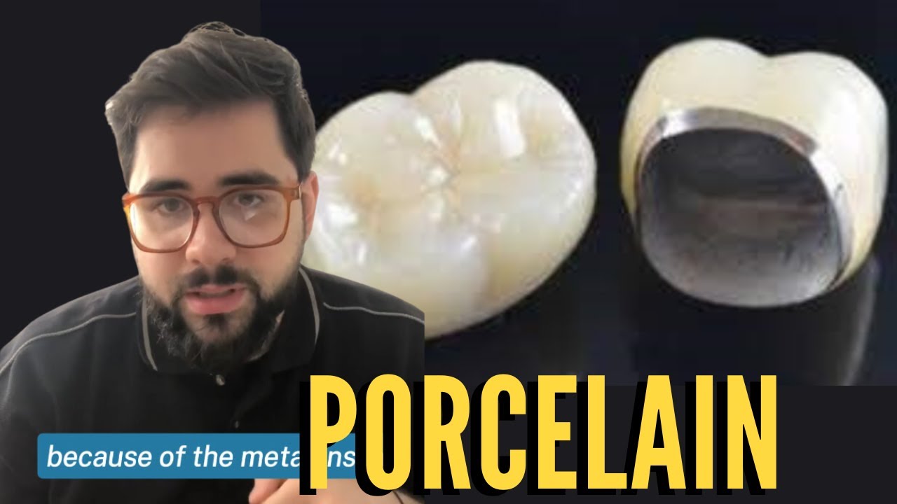 What are Porcelain crowns