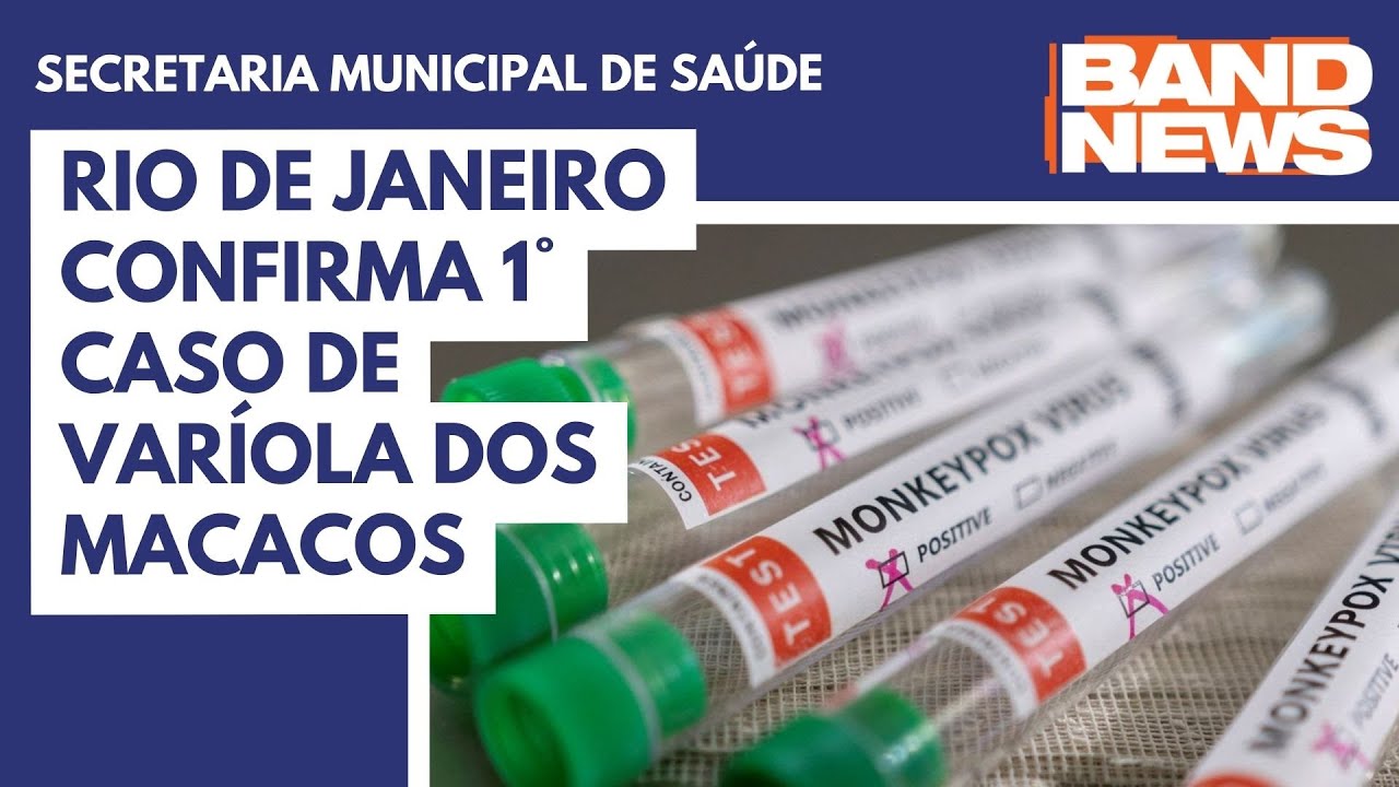 Rio de Janeiro confirma 1° caso de varíola dos macacos