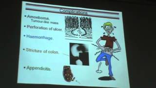 Dr Azza   Protozoa 1   Entamoeba histolytica   YouTube
