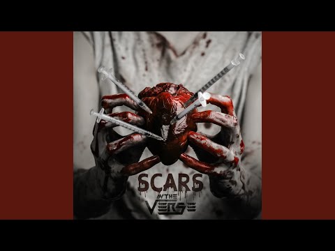 Scars