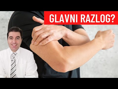 Glavni uzrok BOLI I TRNJENJA RUKU je...