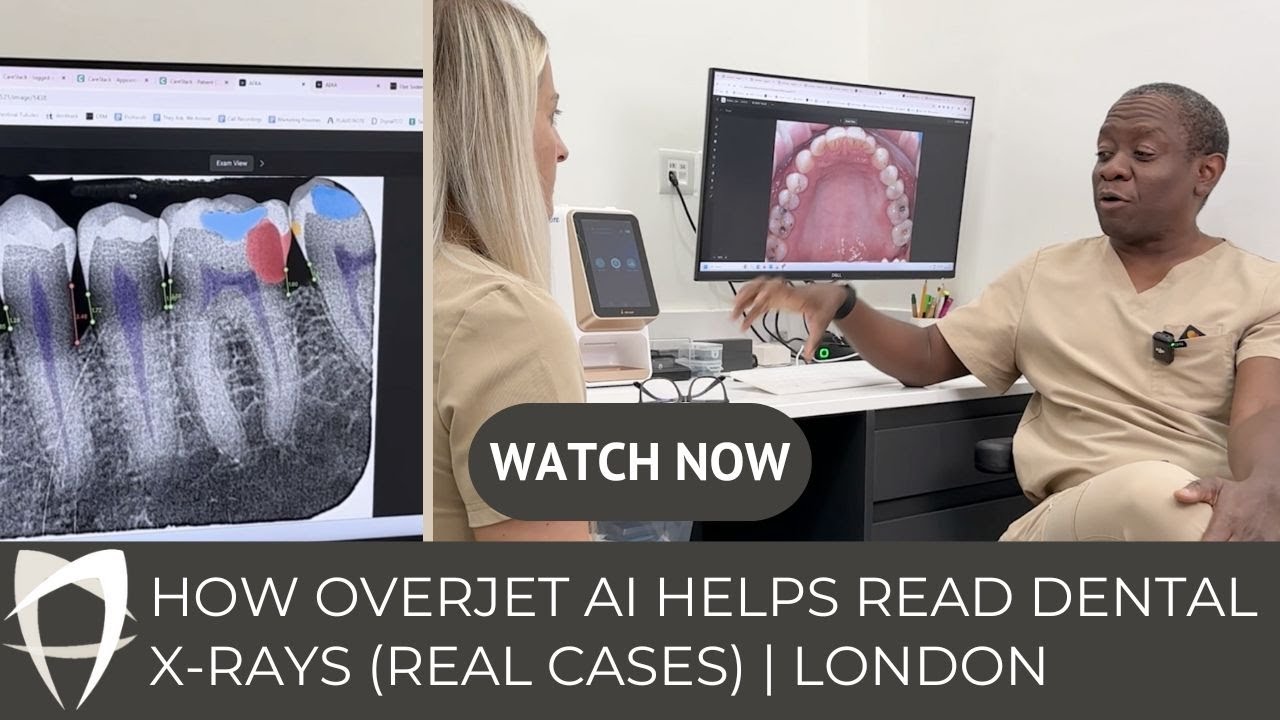 How Overjet AI Helps Read Dental X rays Real Cases | London