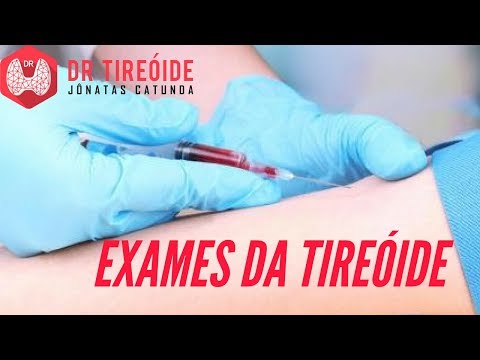 Thyroid tests - TSH, free T4, thyroglobulin, anti-TPO... | Dr. Jônatas Catunda