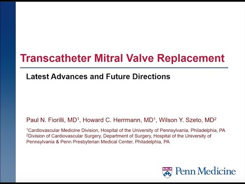 Transcatheter mitral valve replacement: latest advances and future directions