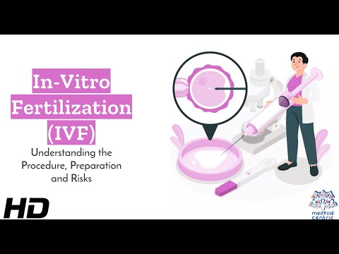 Effects of Cannabis on your body