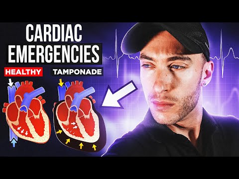 Cardiac Emergencies EMT School | 3 Emergencies You Can't Miss