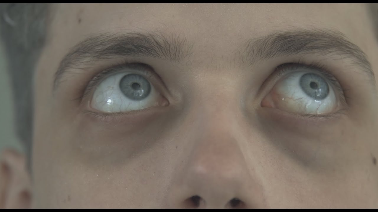 Rare Disease Short Film