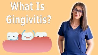 What Is Gingivitis? | How To Treat Gingivitis!