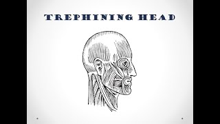 Thing of the Month #5: Trephining Head - Barts Health Archives and Museums