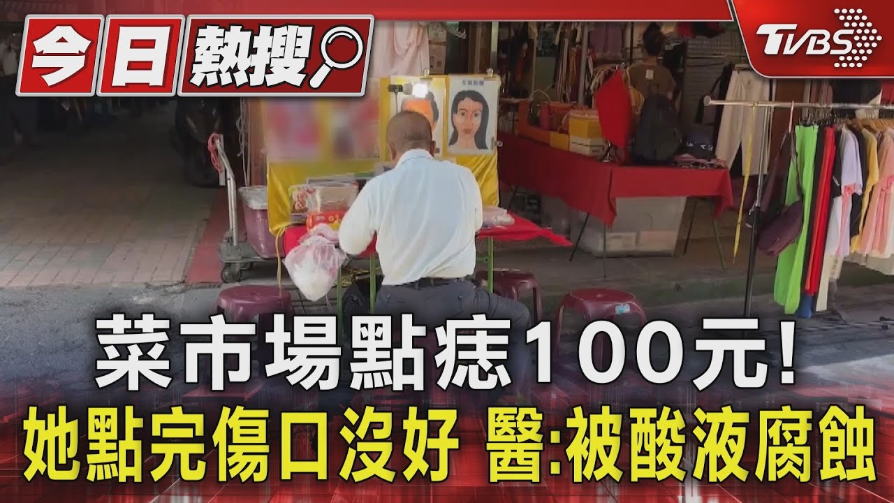 菜市場點痣100元！　她點完傷口沒好醫：被酸液腐蝕