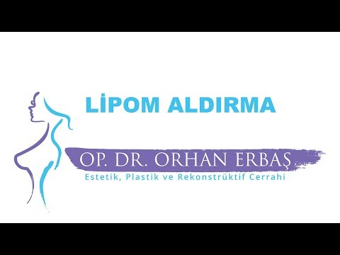 Lipom (Yağ Bezesi) Aldırma