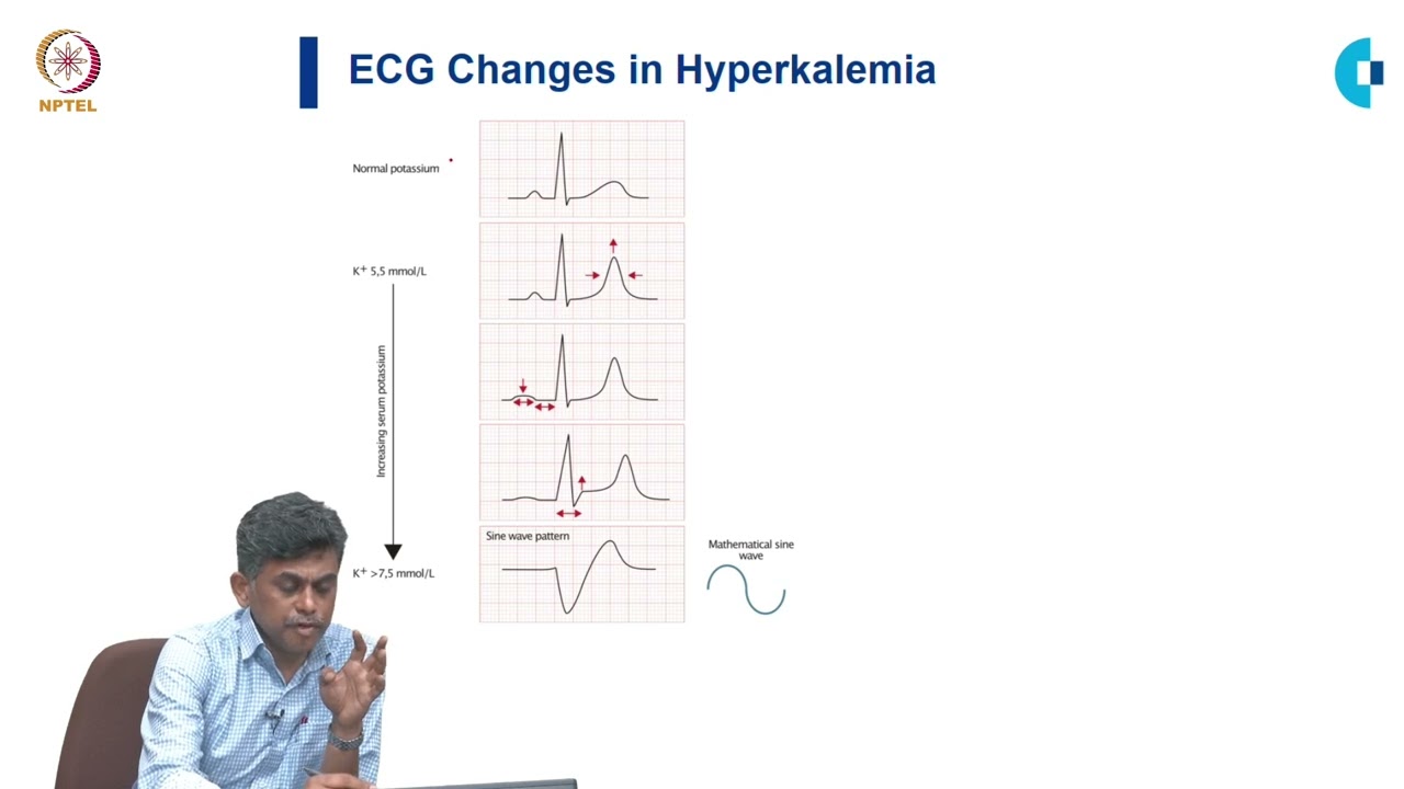 Electrolyte Abnormalities on ECG