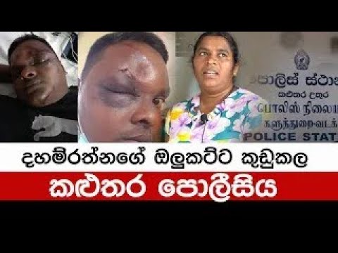 දහම්රත්නගේ ඔලුකට්ට කුඩුකල කළුතර පොලිසිය | police torture in sri lanka