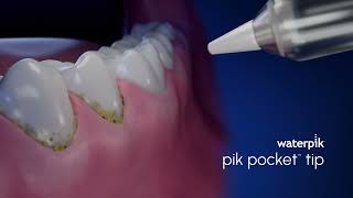 Waterpik Pik Pocket™ Tip
