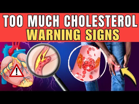 🚨 HIGH CHOLESTEROL: 8 Warning Signs to Monitor Closely