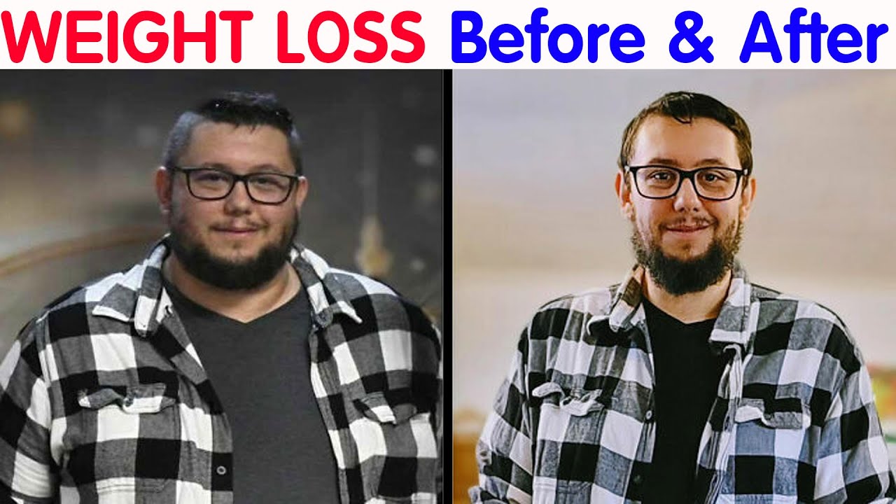 Before And After Pictures Of People Who Used Ozempic For Weight Loss