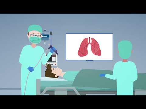 Who performs lung cancer staging?