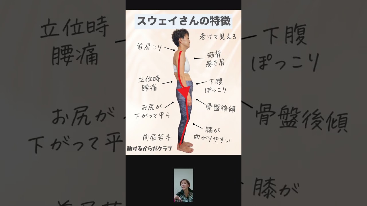 スウェイバックとは？反り腰との違いと見た目の変化
